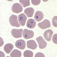 malaria smear